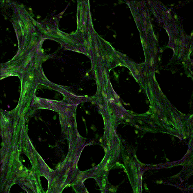 Live confocal timelapse of a perfused, vascularized microtissue